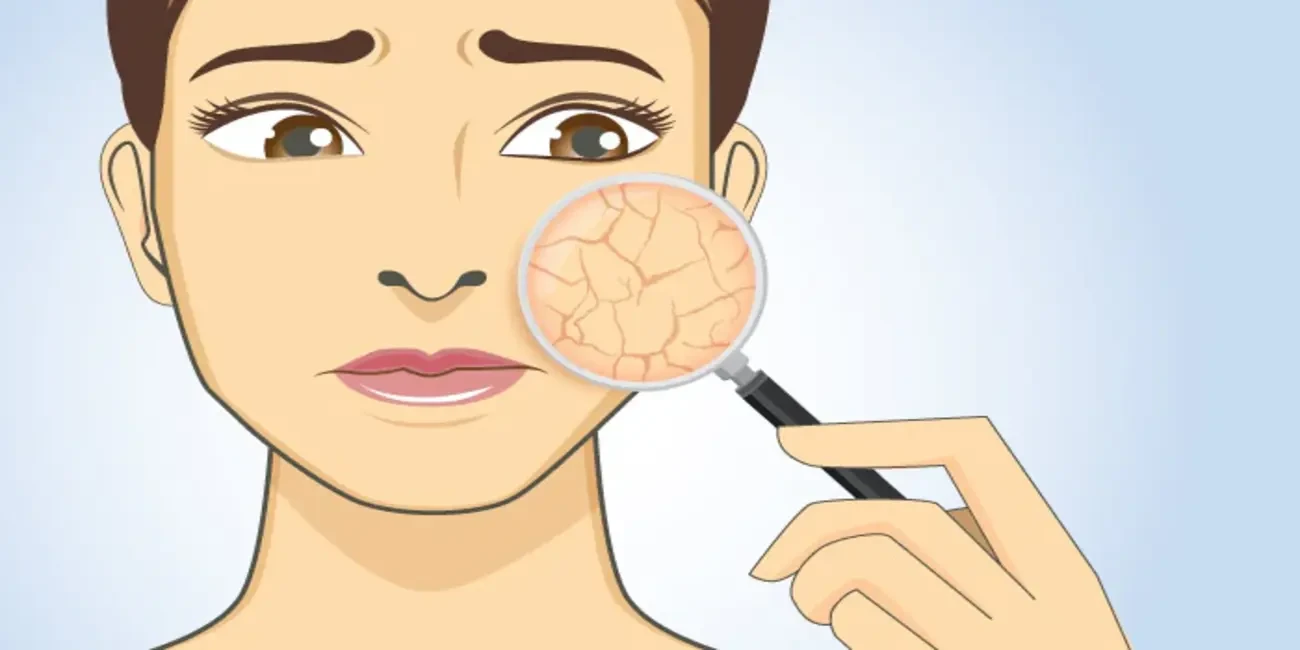 Have Dry Skin issues? Here’s How to fix them!