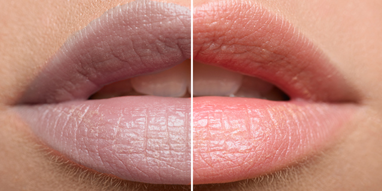 How to Layer Lip Treatments for Maximum Hydration and Protection